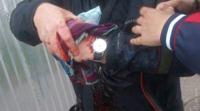 Участнику митинга на Куликовом поле повредило руку взрывом петарды