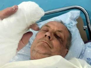 Американський комітет захисту журналістів закликав покарати нападників на головреда з Одещини