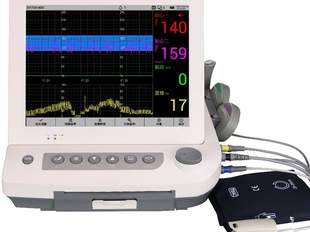 Миколаївський пологовий будинок отримав обладнання для контролю вагітності