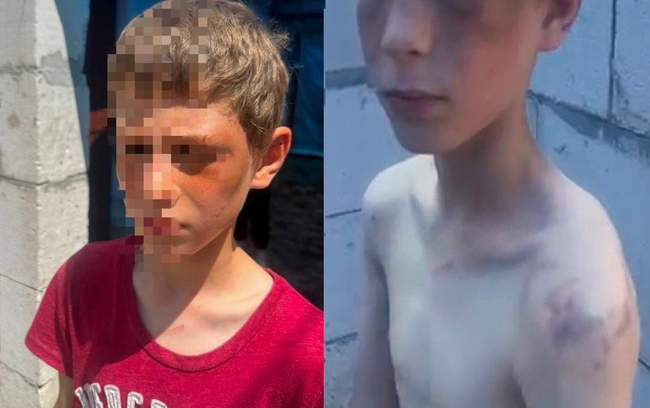 A beaten boy. PHOTO: Pavlo Sushko/Facebook