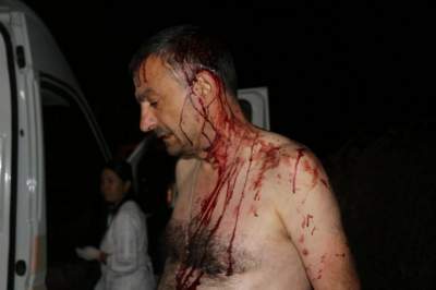 В Одесской области главный редактор местного издания подвергся нападению