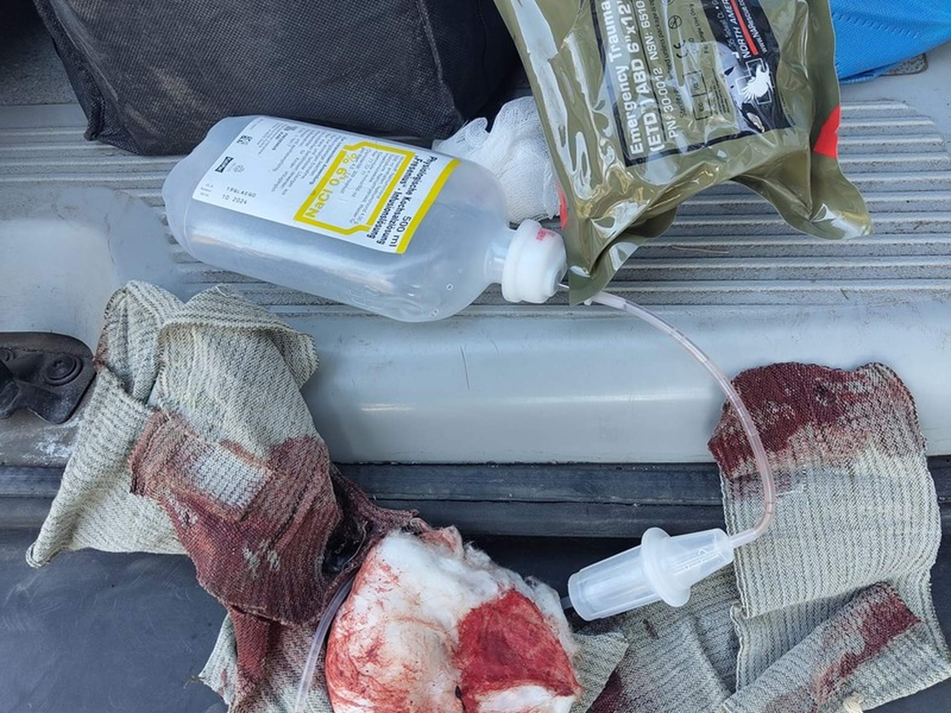 Одеські волонтери врятували жительку Миколаївщини, біля якої здетонував снаряд