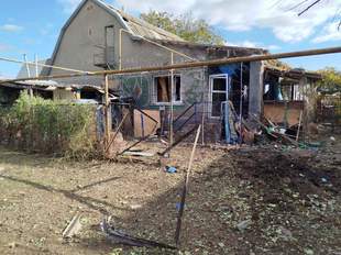 Во время обстрелов Херсонщины оккупанты ранили гражданского человека