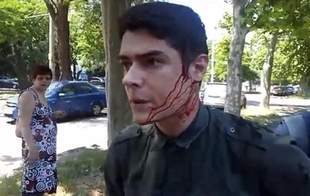 Подозреваемых в нападении на лидера Одесского «Автомайдана»  оставили в СИЗО еще на 2 месяца