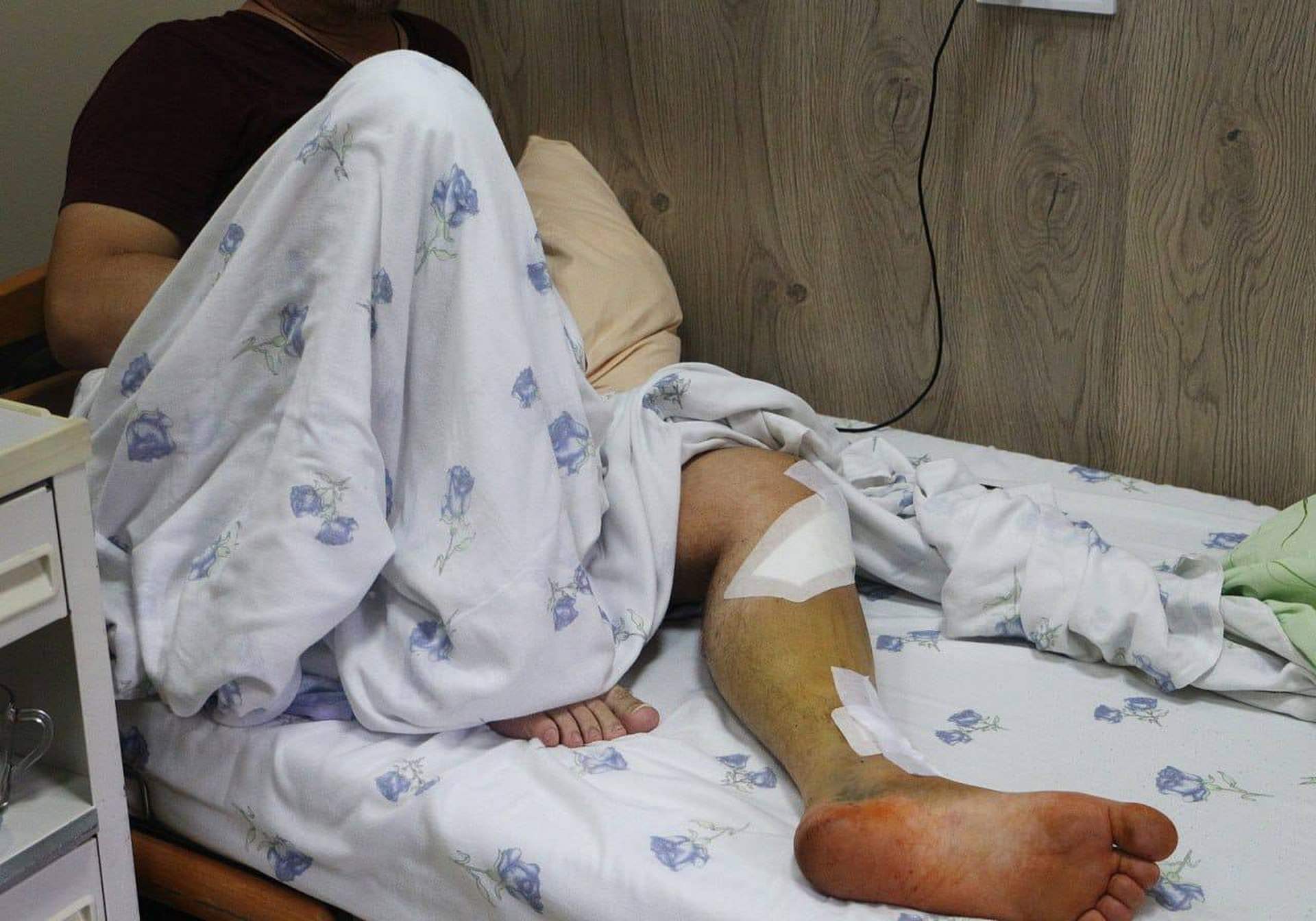 Школи та садочки Одеси постраждали через ракетний удар росії