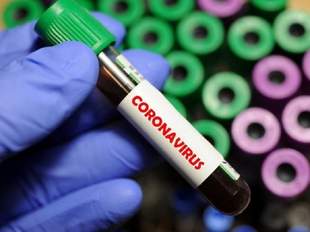 На Одещині внаслідок COVID-19 з початку року померли 47 жителів