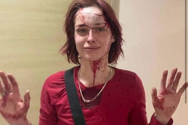 Антонина Токмакова после избиения. ФОТО: Думская