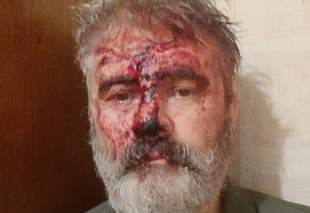 У Києві скоєно напад на митрополита Кримського та Сімферопольського ПЦУ