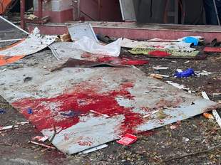 Another citizen, wounded on November 18, dies in Odesa hospital