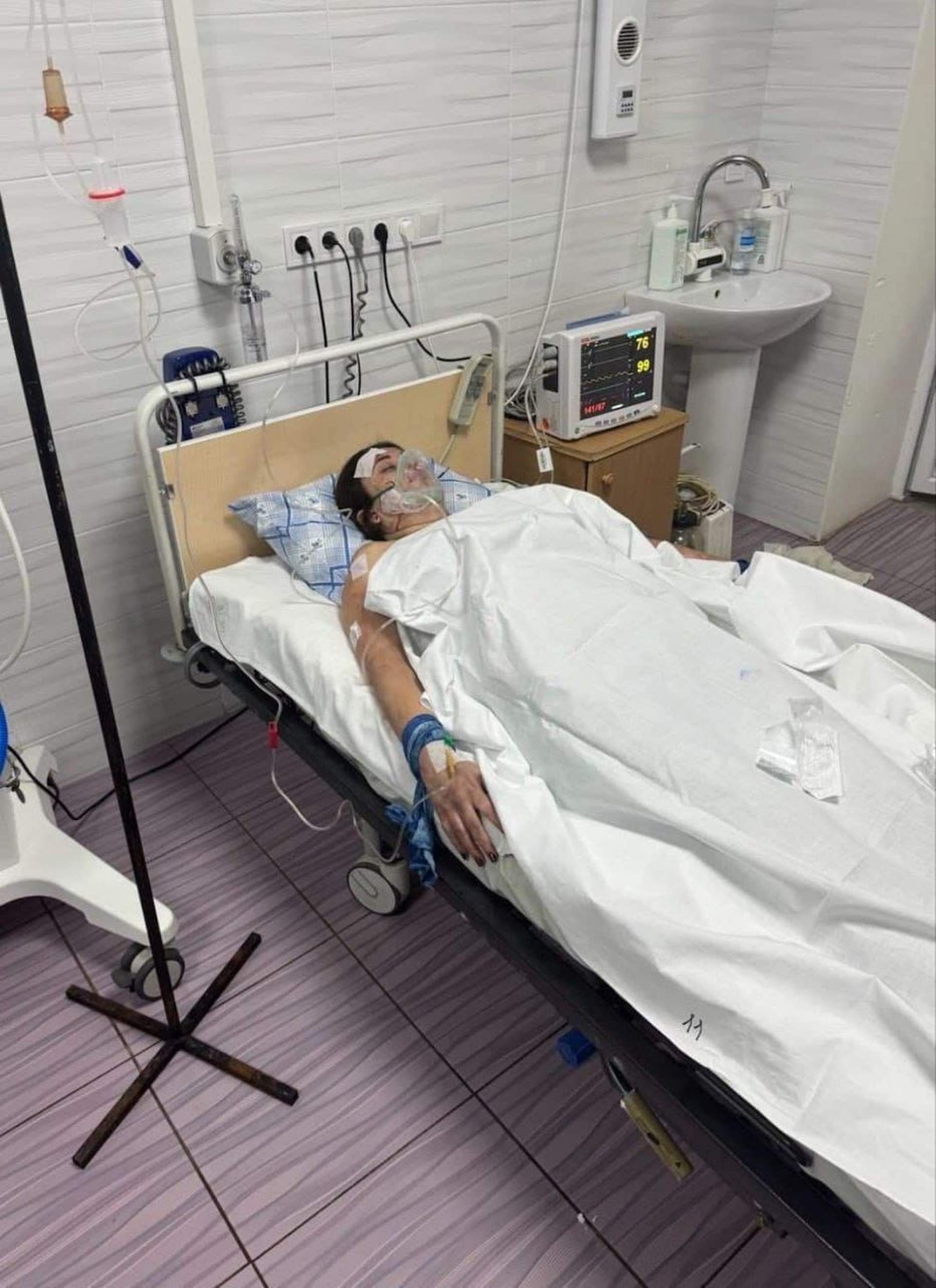 Під Одесою підірвали авто Української добровольчої армії: що відомо про постраждалих
