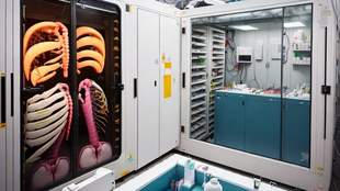 В Николаеве выделили еще 10 миллионов на создание лаборатории трансплантации органов