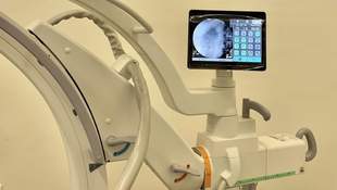 Mykolaiv hospital receives modern X-ray machine from France