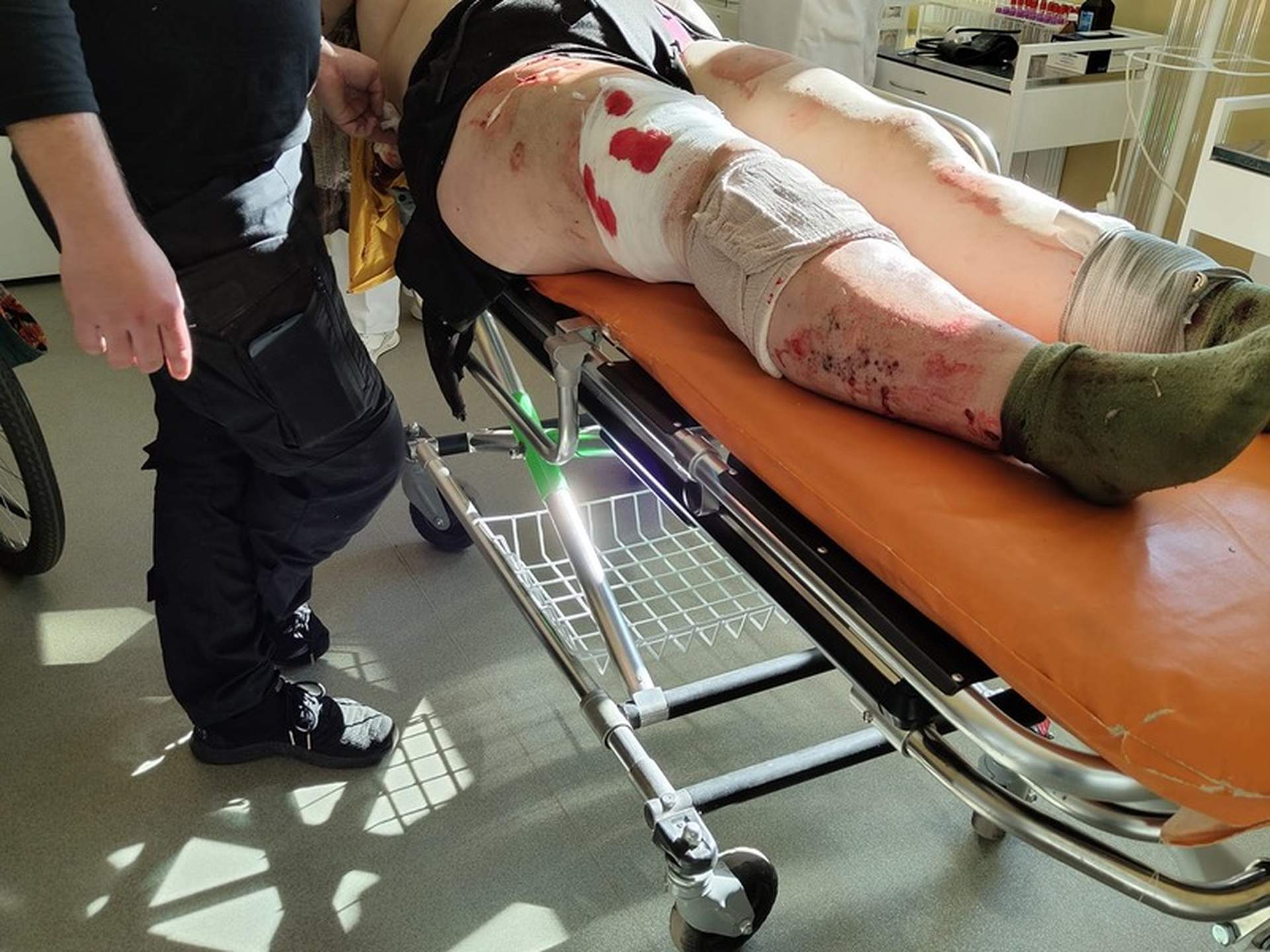 Одеські волонтери врятували жительку Миколаївщини, біля якої здетонував снаряд